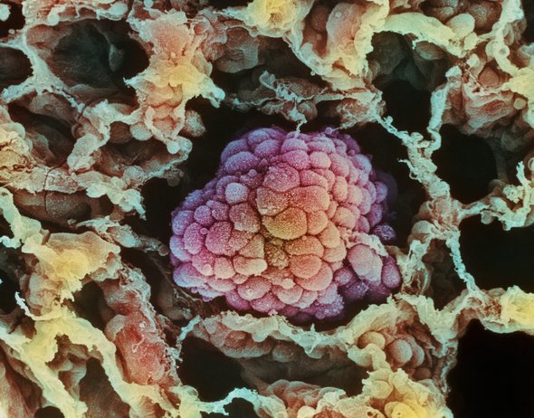 cancer immunotherapy nobel nota